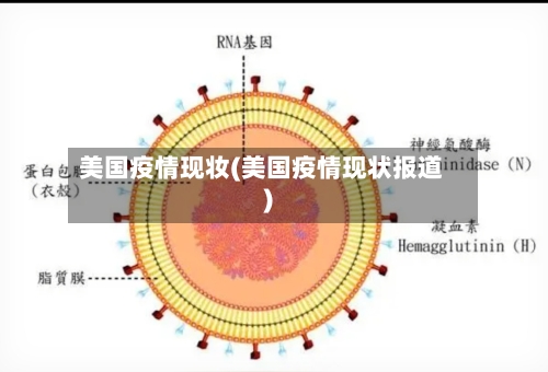 美国疫情现妆(美国疫情现状报道)