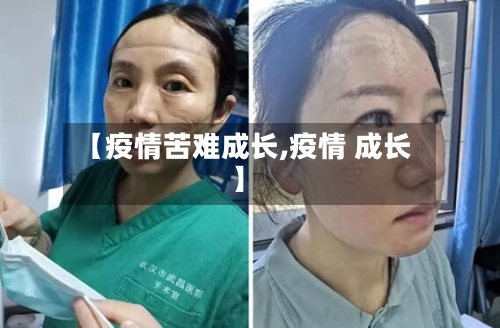 【疫情苦难成长,疫情 成长】-第2张图片