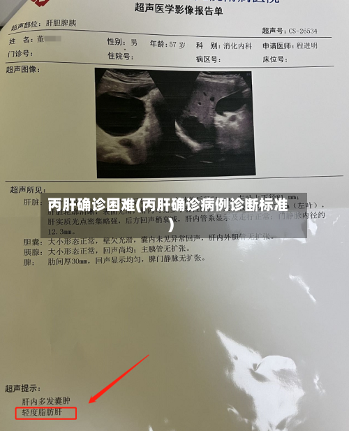 丙肝确诊困难(丙肝确诊病例诊断标准)-第2张图片