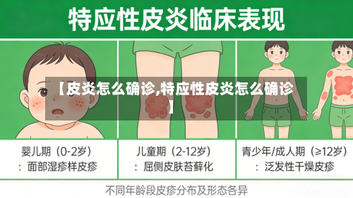 【皮炎怎么确诊,特应性皮炎怎么确诊】-第3张图片