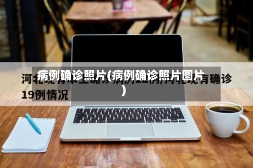 病例确诊照片(病例确诊照片图片)-第2张图片