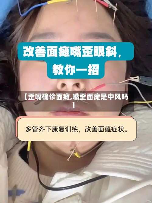 【歪嘴确诊面瘫,嘴歪面瘫是中风吗】