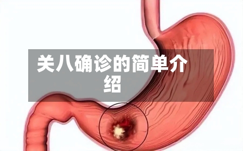 关八确诊的简单介绍-第2张图片